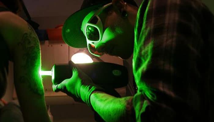 cómo borrar tatuajes