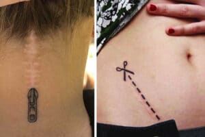 Tatuajes en cicatrices