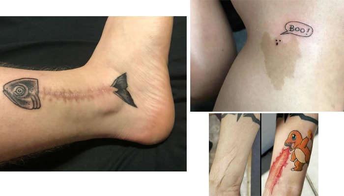 tatuajes cicatrices